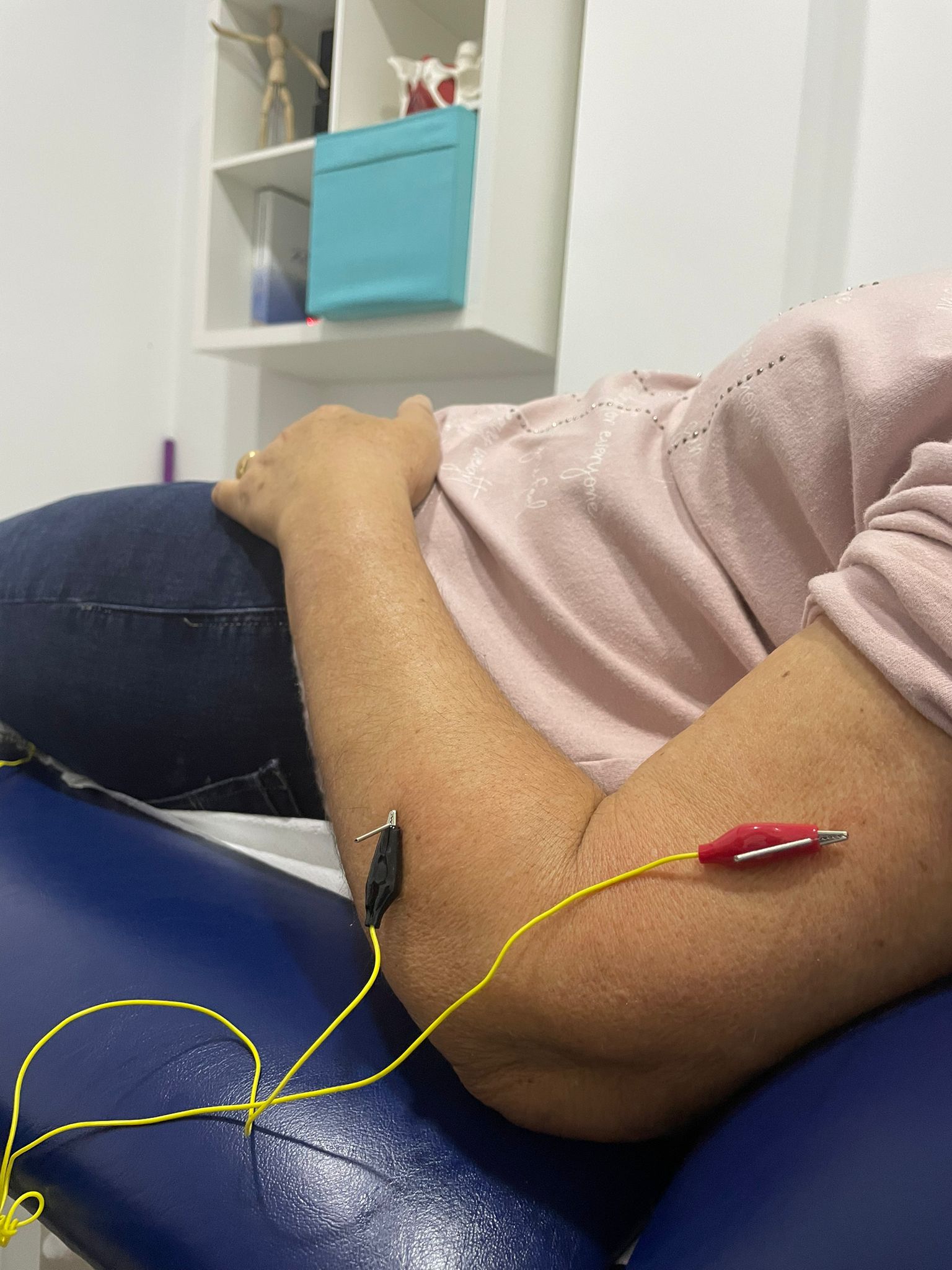 neuromodulación